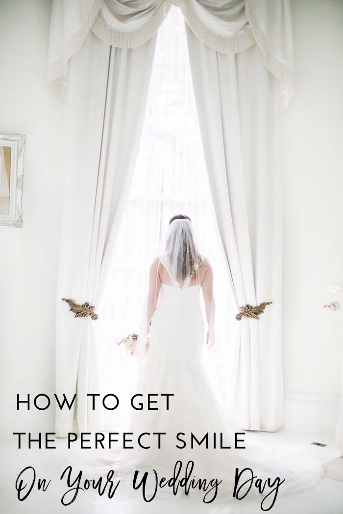 How to Get the Perfect Smile On Your Wedding Day